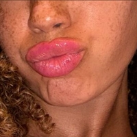 Abtherebel Alaston
