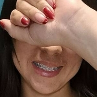 anadavilag9 Alaston