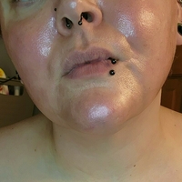 blemishedbeauty Alaston