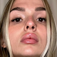 cassidyraw Alaston