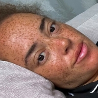 frecklebabee Alaston