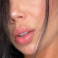 lopezeli Alaston