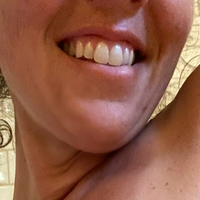 sneakinsalliefree Alaston